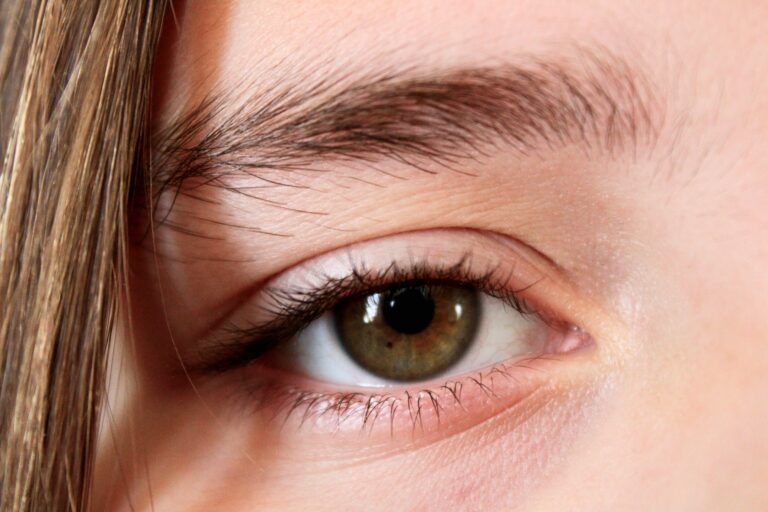 Imagen de un ojo